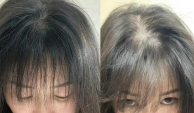 防脱育发产品哪个牌子有效？2026公认有效防脱育发的产品排行榜前十名，实力榜健发固发效果最好的排名第一